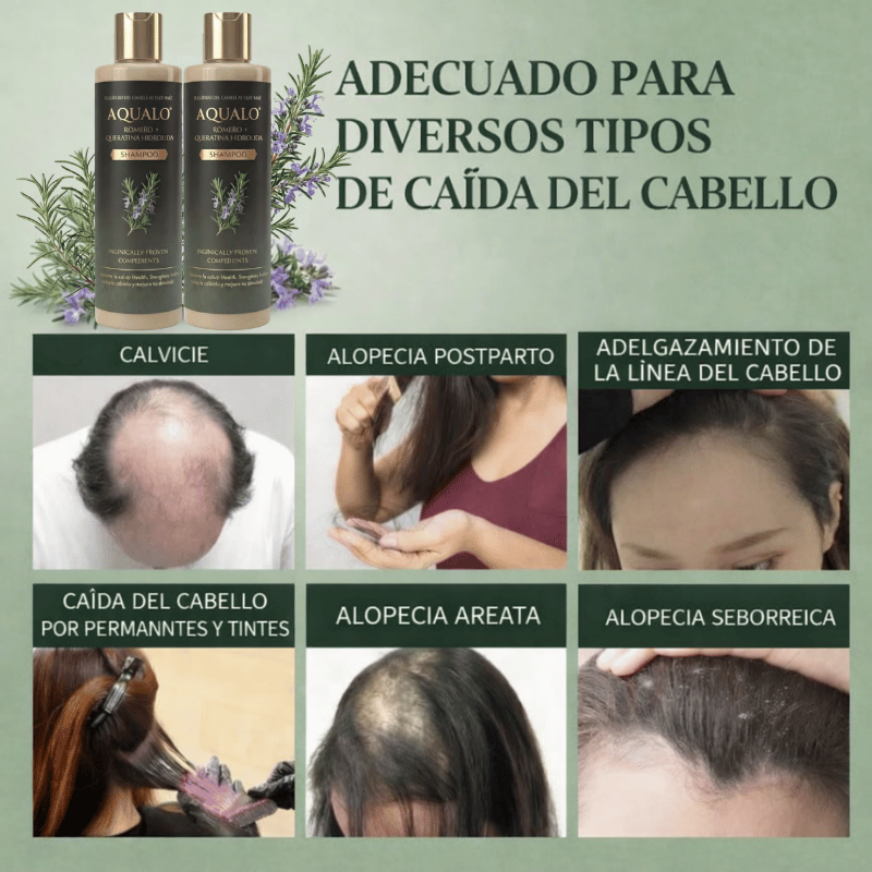 AQUALO™ Shampoo Anticaída y Crecimiento