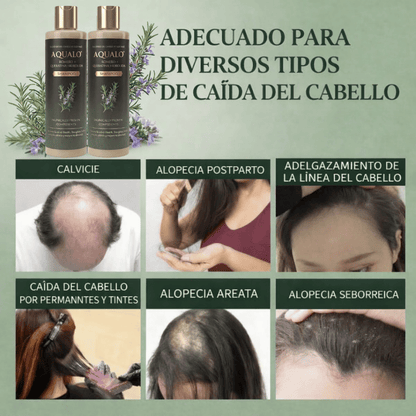 AQUALO™ Shampoo Anticaída y Crecimiento