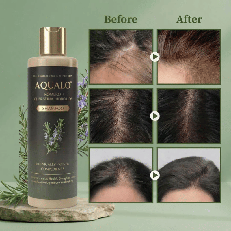 AQUALO™ Shampoo Anticaída y Crecimiento