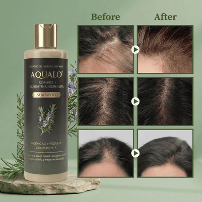 AQUALO™ Shampoo Anticaída y Crecimiento