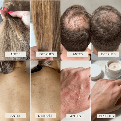 Cabezal de Ducha Aqualo® con Filtro Antisarro